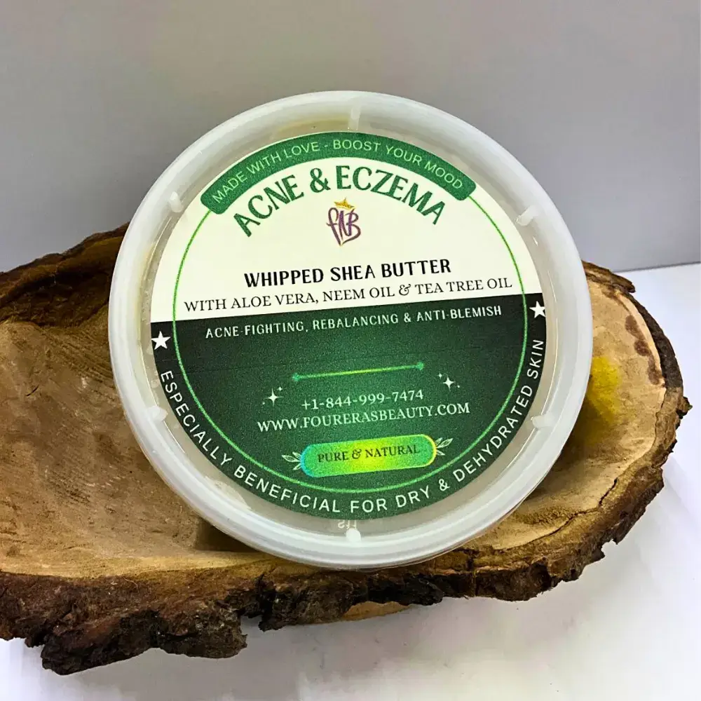 Acne and Eczema Whipped Shea Butter for healing, anti-blemish Acne & Eczema Shea Butter, Fourera Neem and Tea Tree skin treatment